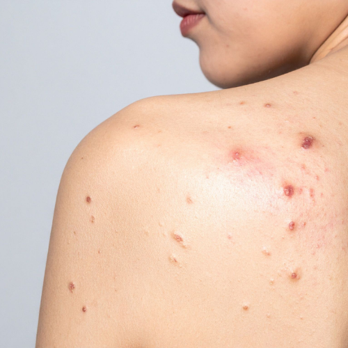 Skin conditions treated at SkinVive by Dr. Karishni Chittarvu